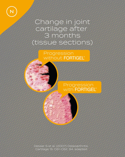 Cartilage change comparison photos